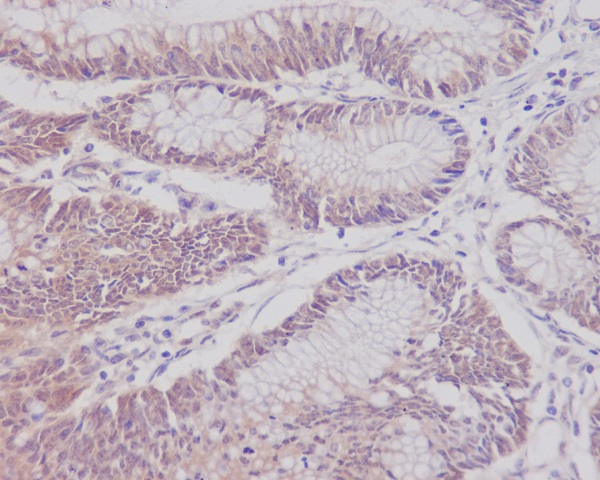 CD3 epsilon Ab