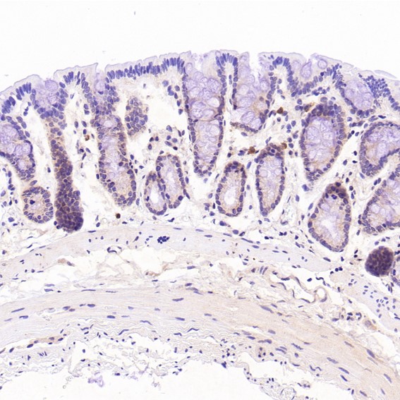 CD3 epsilon Ab