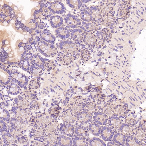 CD3 epsilon Ab