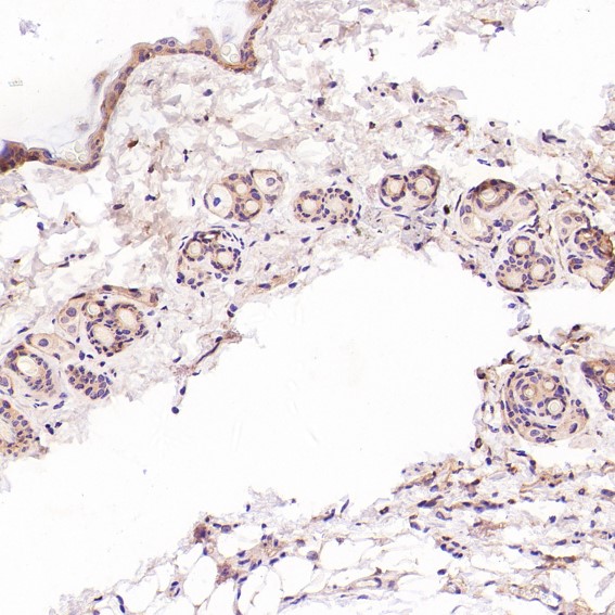 CD3 epsilon Ab