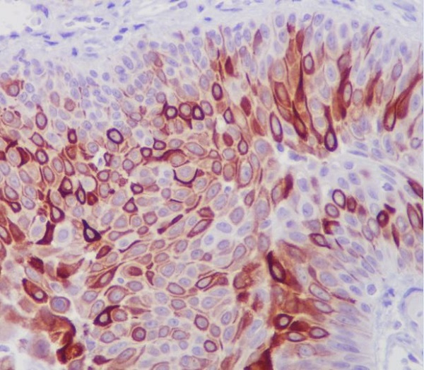 Cytokeratin 10 Ab