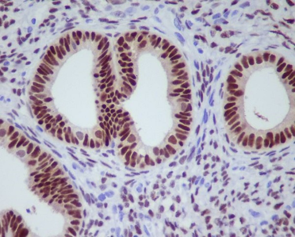 Progesterone receptor Ab