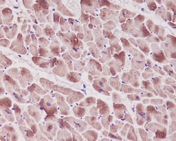 Troponin I Ab
