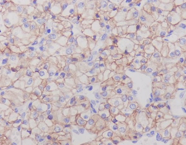 Carbonic anhydrase 9 Ab