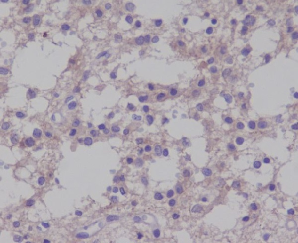 p-Trk B (Y817) Ab