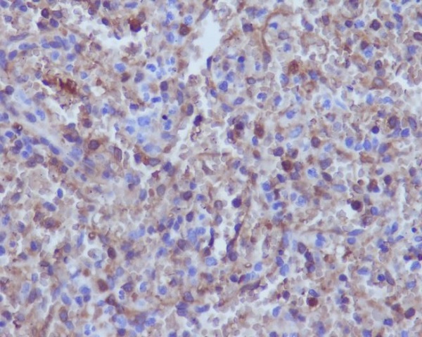 Hemoglobin alpha Ab