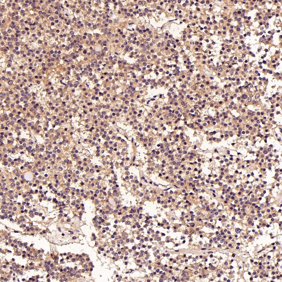 FGFR1 Ab