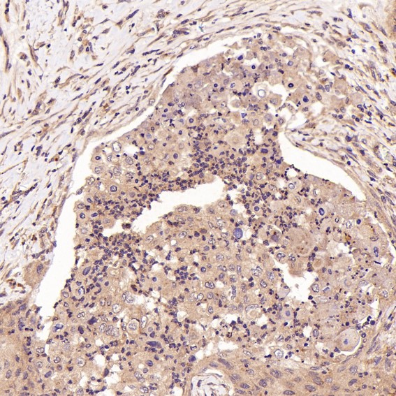 FGFR1 Ab