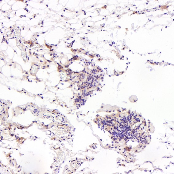 FGFR1 Ab
