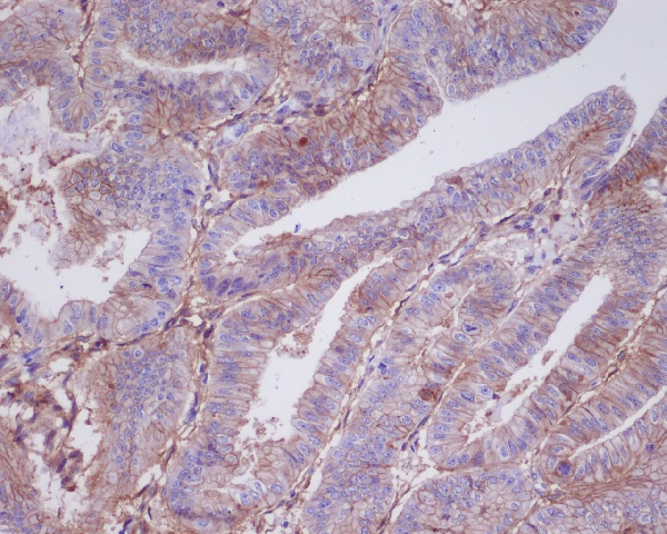 Trophoblast glycoprotein Ab