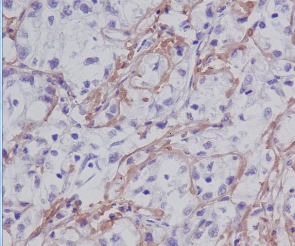 Fibronectin Ab