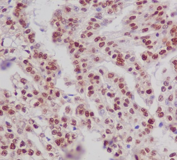 p-Estrogen receptor (S118) Ab