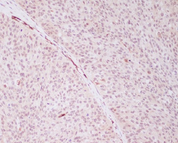 PRPF19 Ab