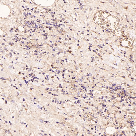 CD168 Ab