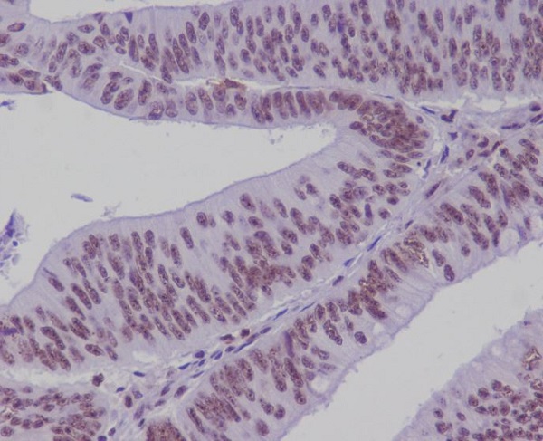 TCF7L2 Ab