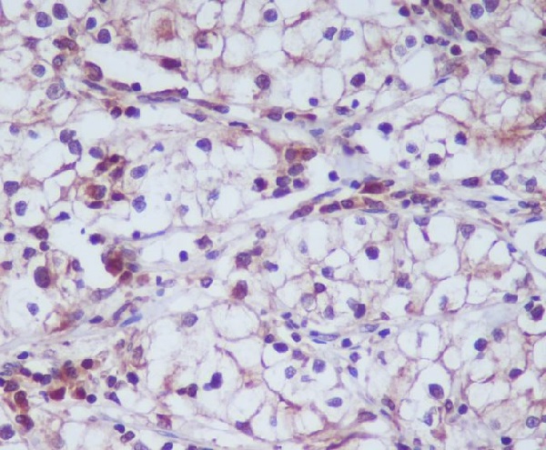 CD13 Ab
