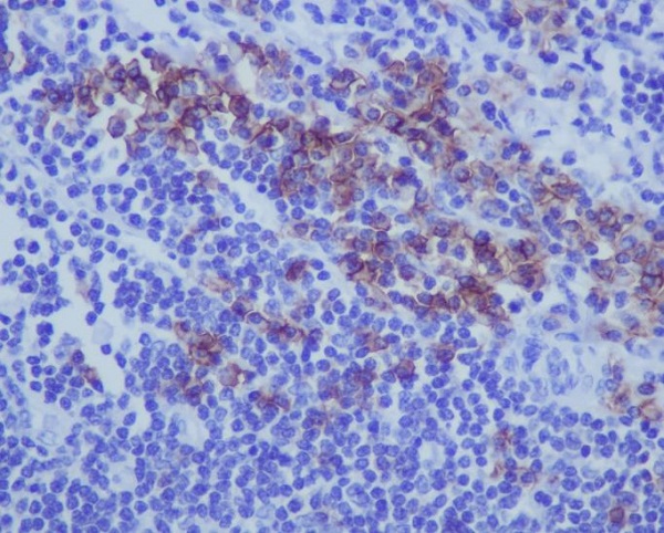 CD38 Ab