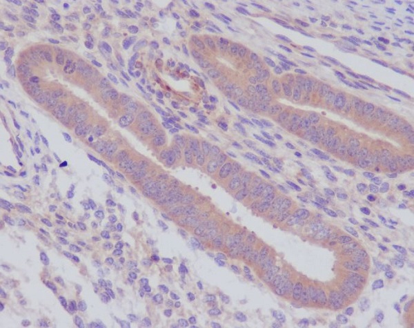 Caspase 8 Ab