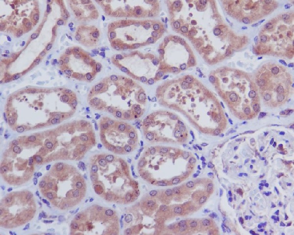 Cleaved-Caspase 3 p12 Ab