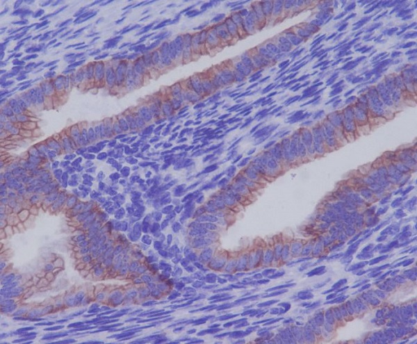 Cytokeratin 7 Ab