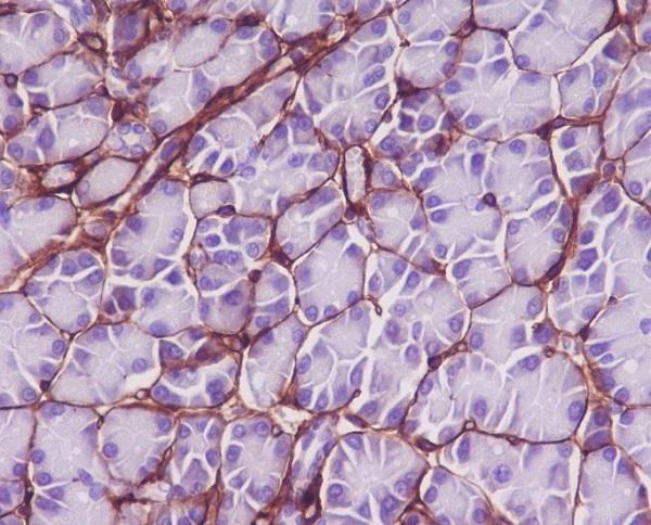 Collagen VI Ab