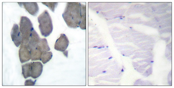 p-Acetyl CoA carboxylase 1 (S80) Ab