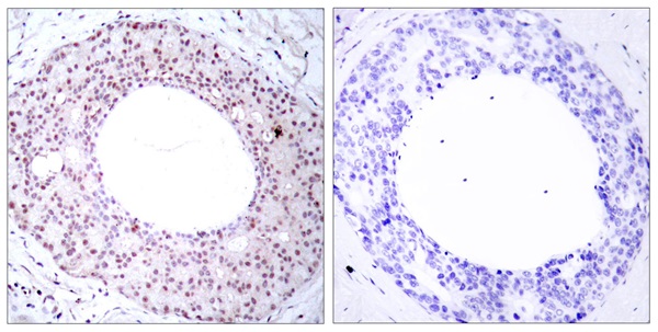 p-NF-kB p65 (T254) Ab