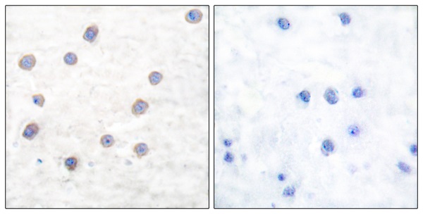 p-Tyrosine hydroxylase (S40) Ab