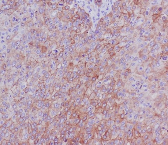 Integrin beta 4 Ab
