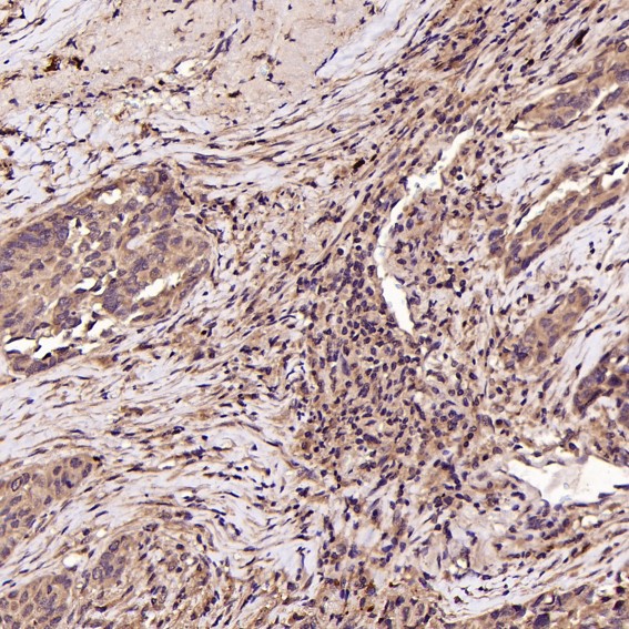 Integrin alpha 2b Ab