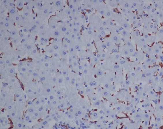 CD163 Ab