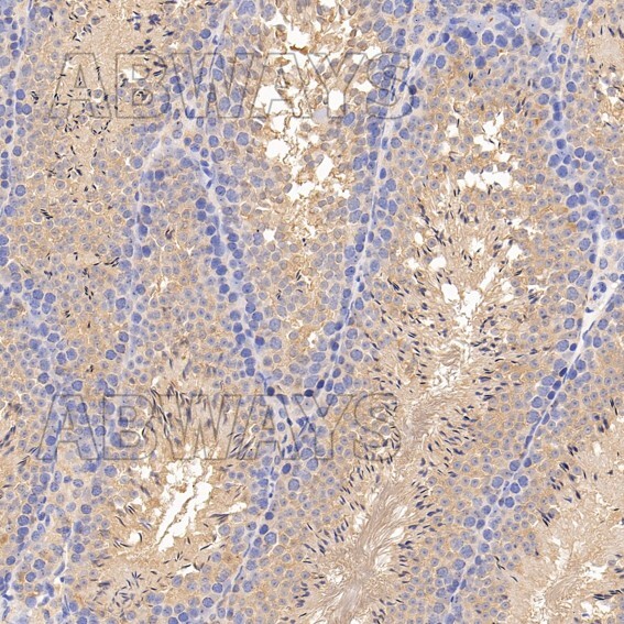 YTHDF2 Ab