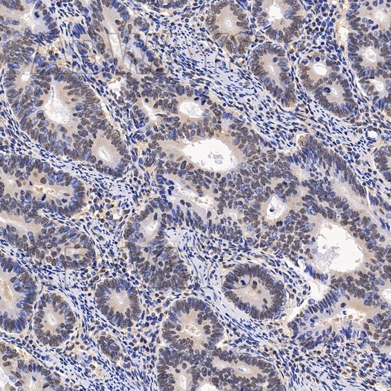 SNAI1 Ab