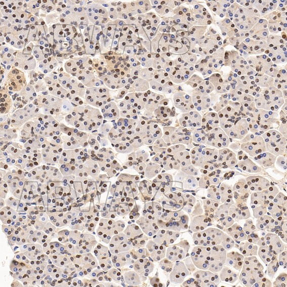 SNAI1 Ab