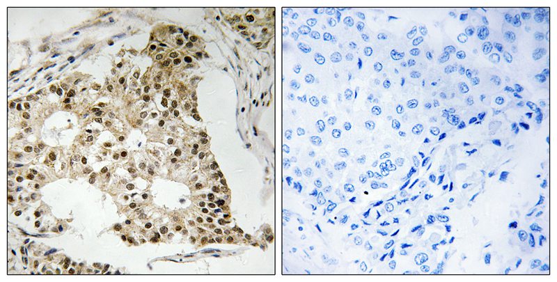 p-Retinoic acid receptor alpha (S77) Ab