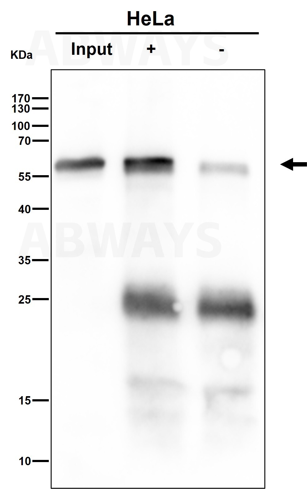 alpha 4A Tubulin Ab