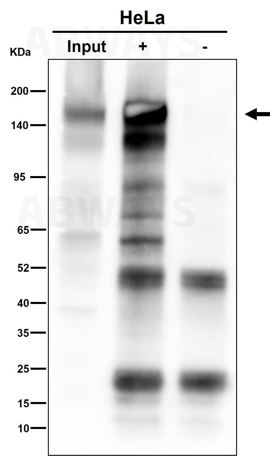 EGFR Ab