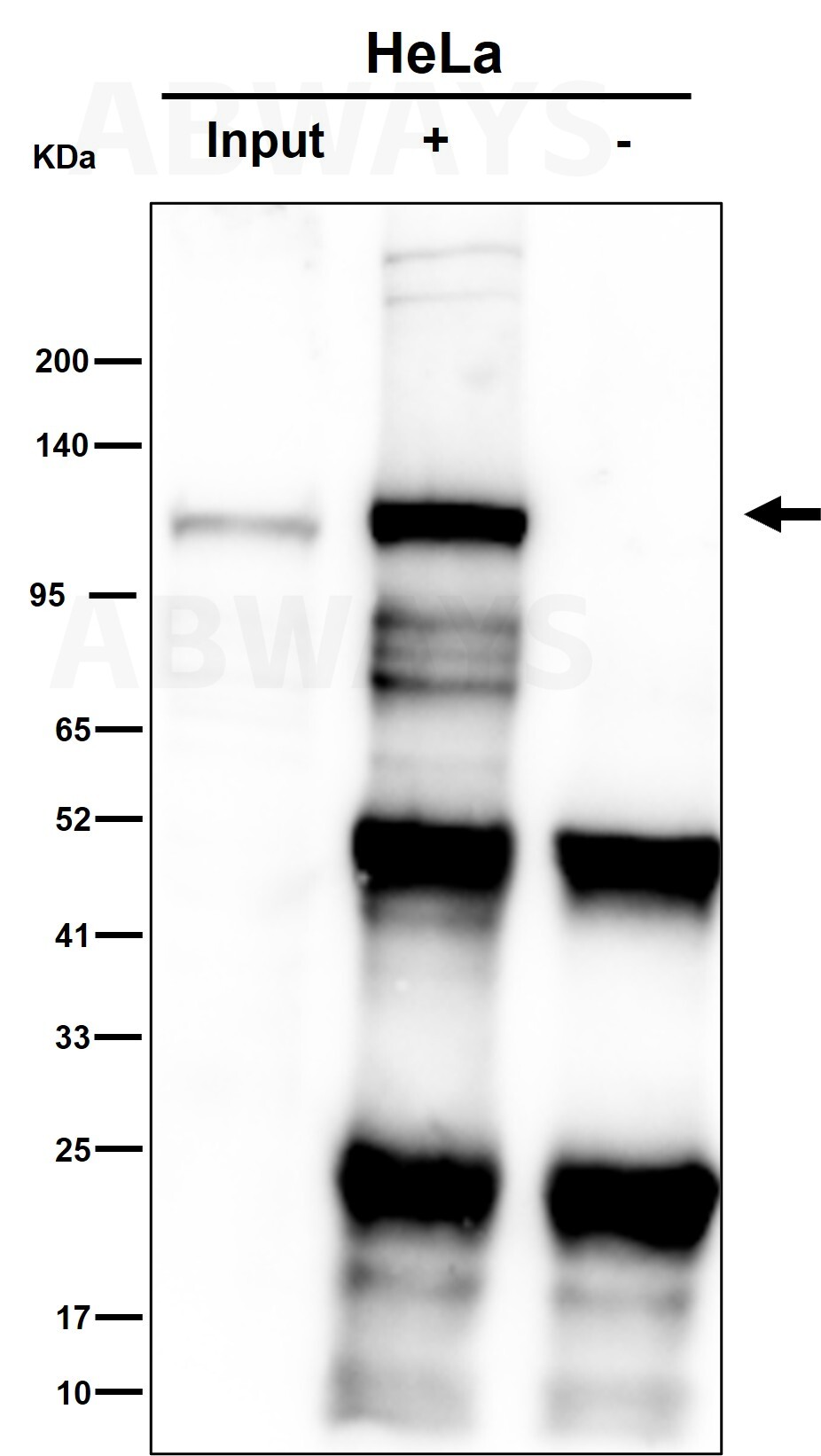 Focal adhesion kinase 1 Ab