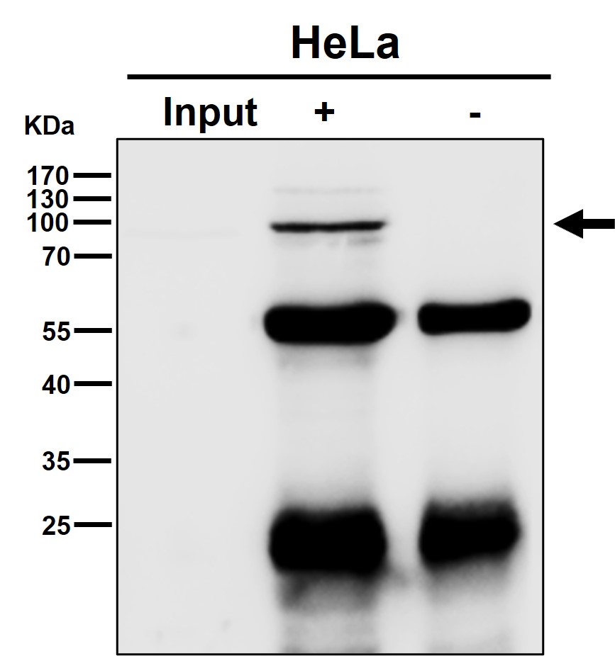 PI3 kinase p85 beta Ab