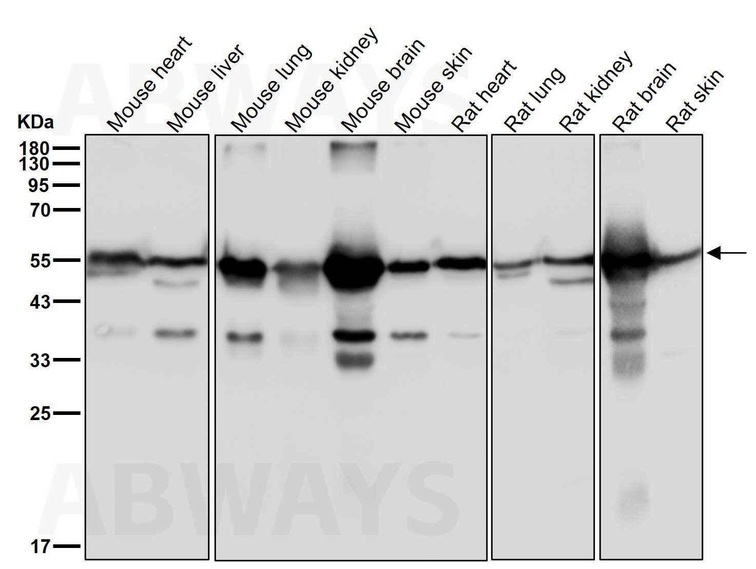 beta Tubulin Ab
