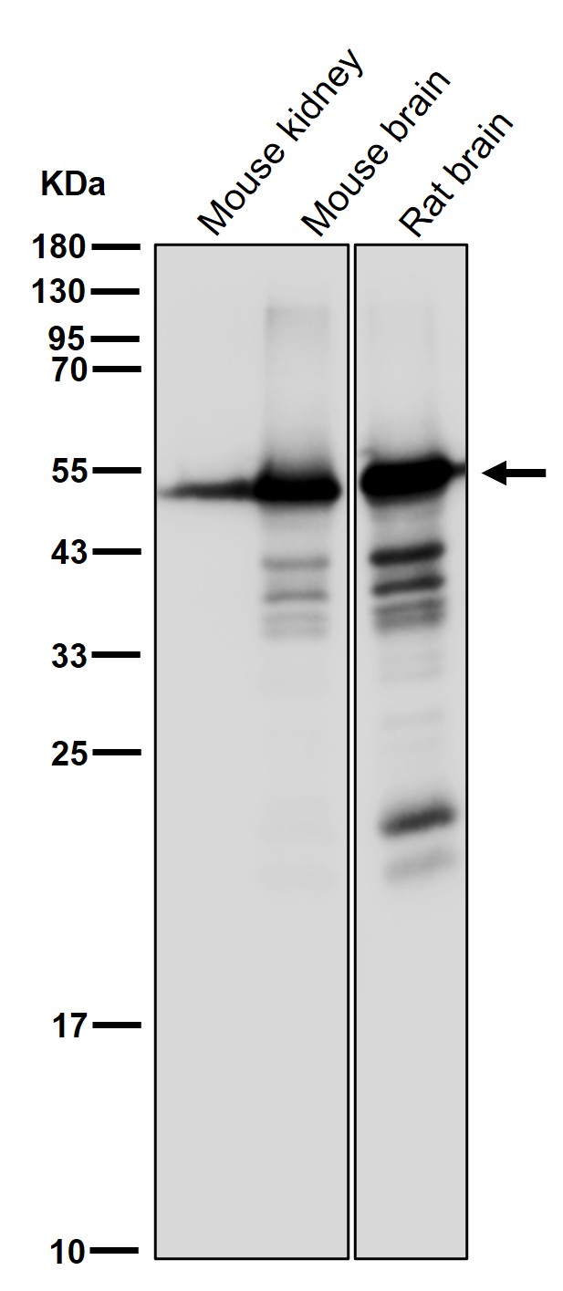 beta III Tubulin Ab