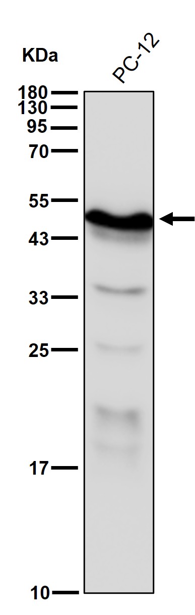 beta III Tubulin Ab