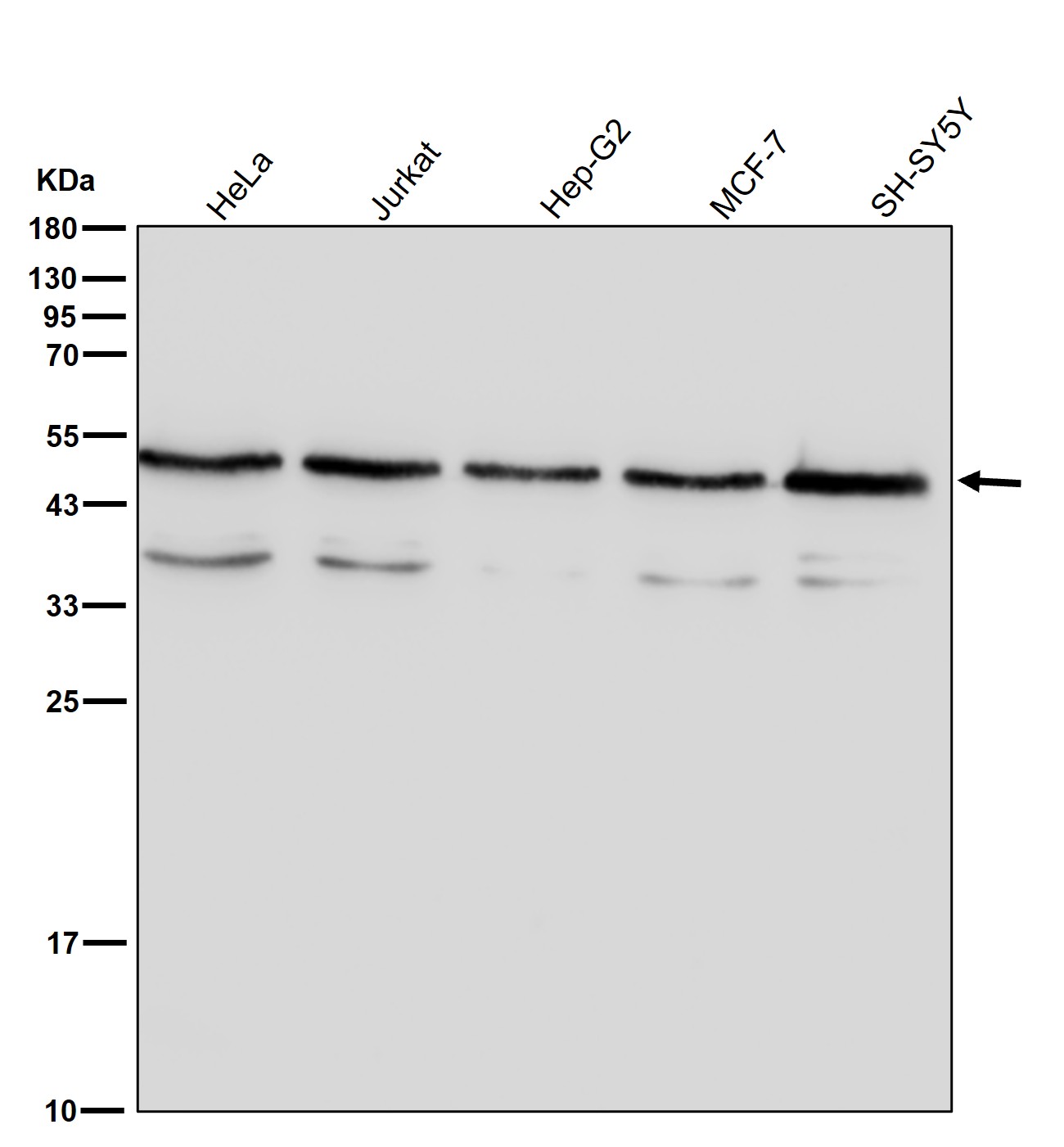 beta Tubulin Ab