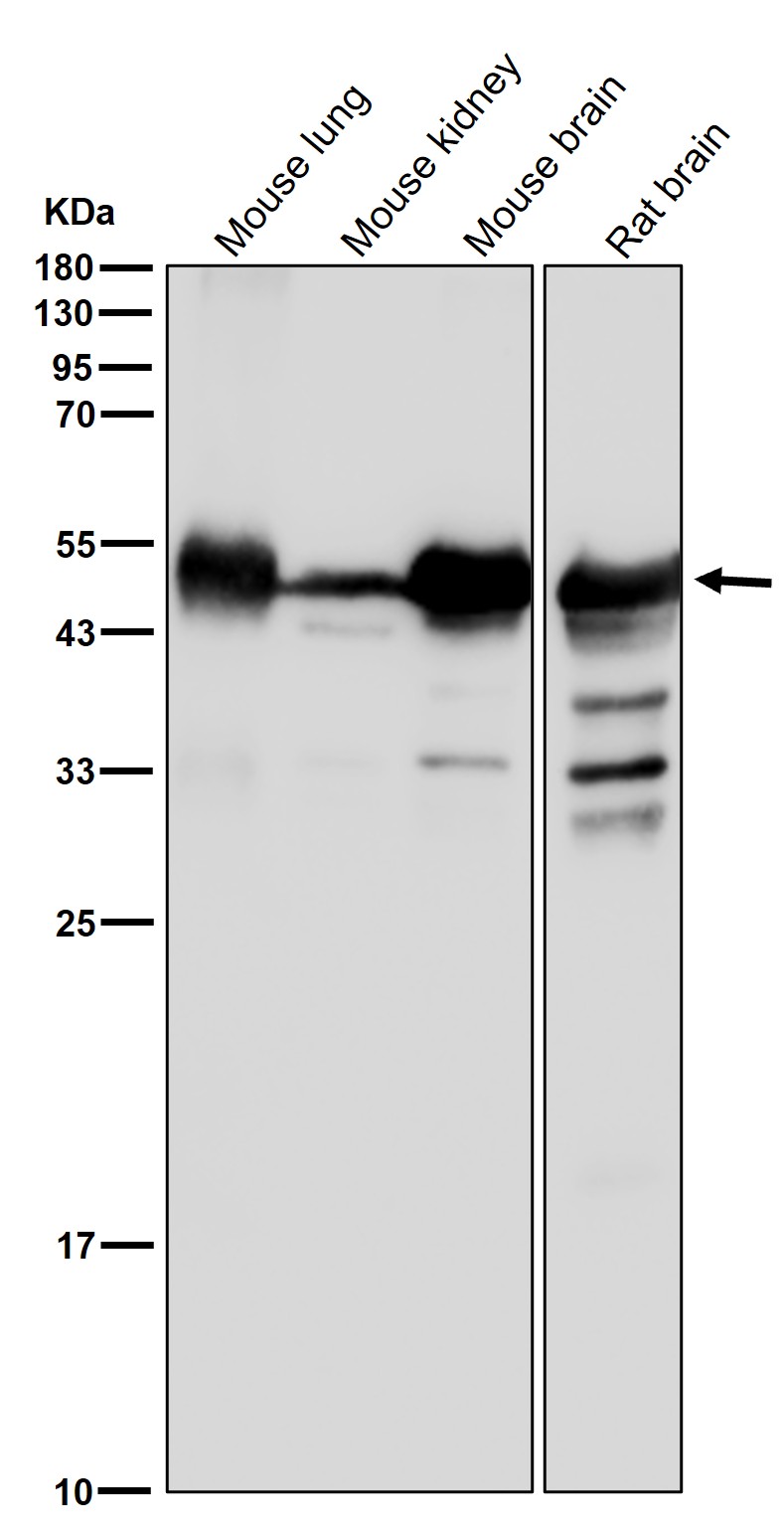 beta Tubulin Ab