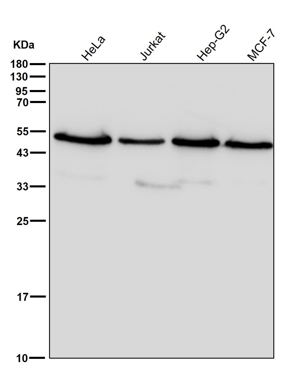 beta III Tubulin Ab