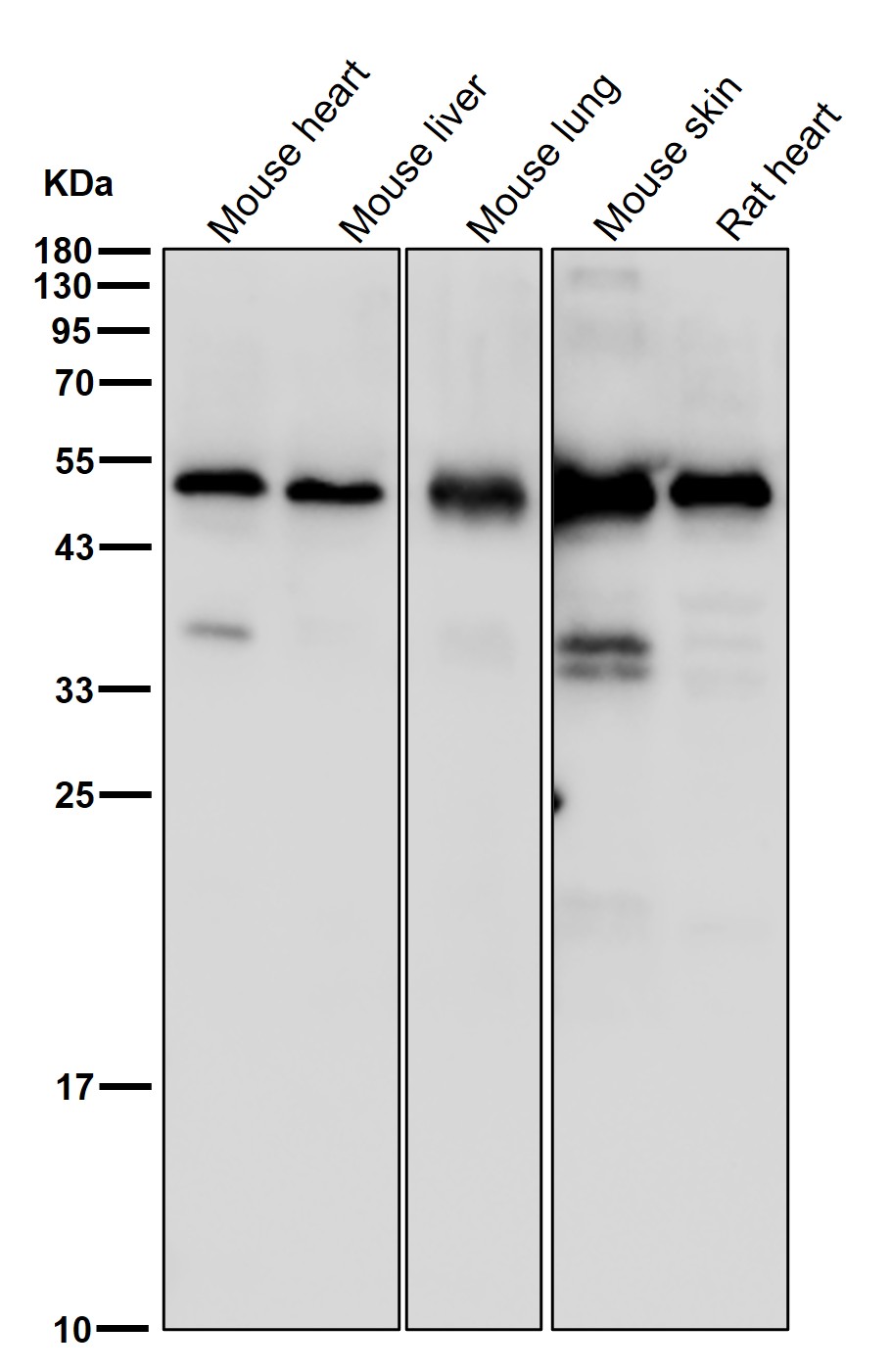 beta III Tubulin Ab