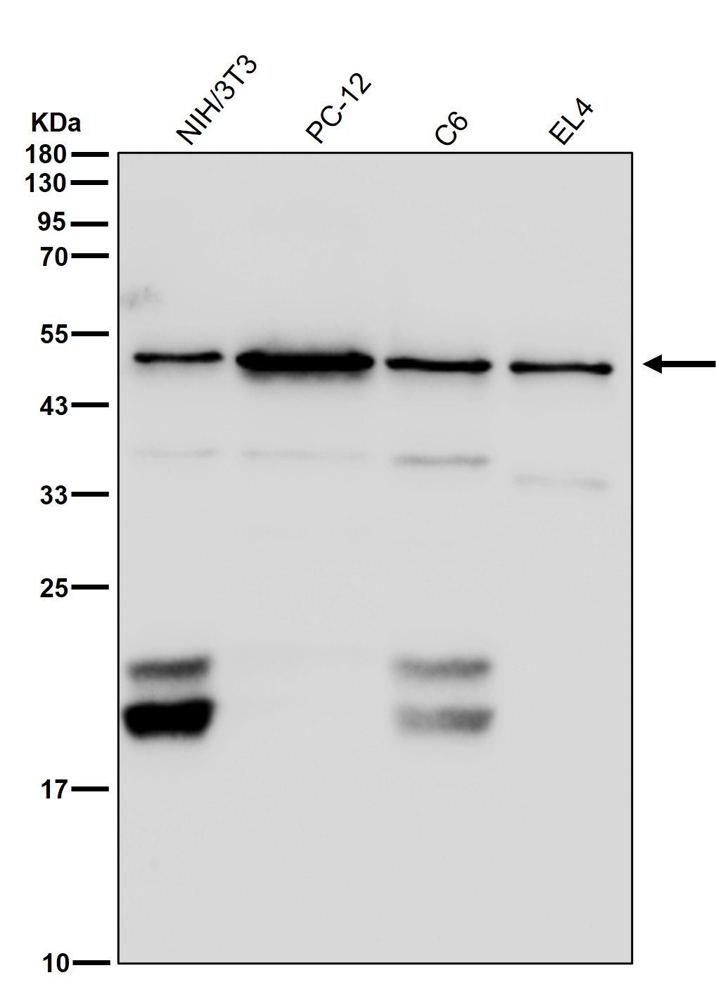 beta III Tubulin Ab