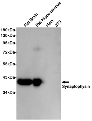 Synaptophysin Ab