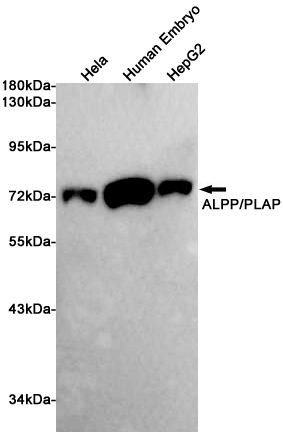 ALPP Ab