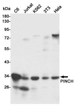 LIMS1 Ab